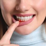 Battling Periodontal Disease: Unveiling The Secrets To Gum Health