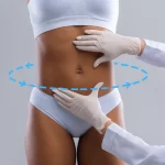 Cost of Lipo 360 – What do you need to know?