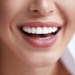 Are Dental Veneers Made For Me? 